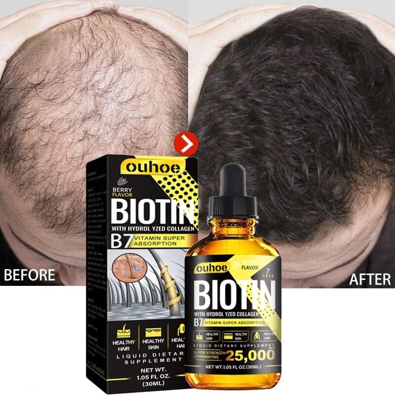 Биотиновая Серум За Растеж на Продукти за Коса Срещу Косопад Бързо развиващ се Грижи За Косата Етерично Масло За Здравето на Кожата