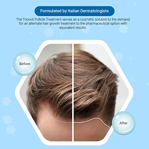 Лосион за коса Tricovit Forte - Серум за растеж на косата С андрогенами и ДХТ блокери За Изтъняване на косата - Допринася за укрепване